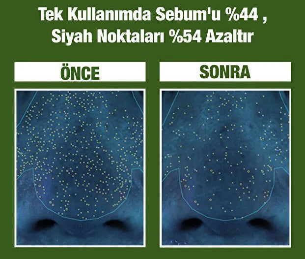 P.CALM Fesleğenli Köpüklü Kil Maskesi