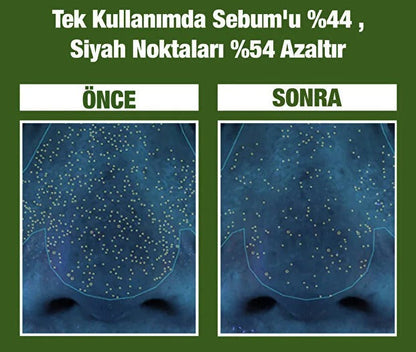 P.CALM Fesleğenli Köpüklü Kil Maskesi